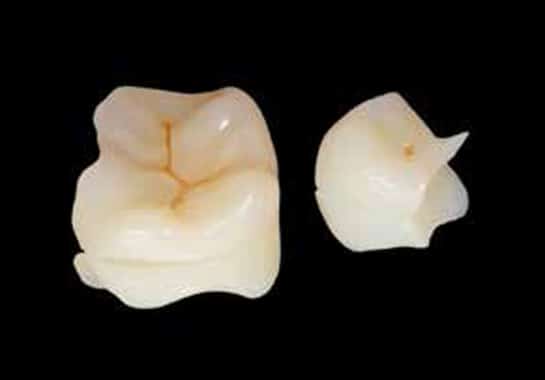 biomimetic restorative dentistry