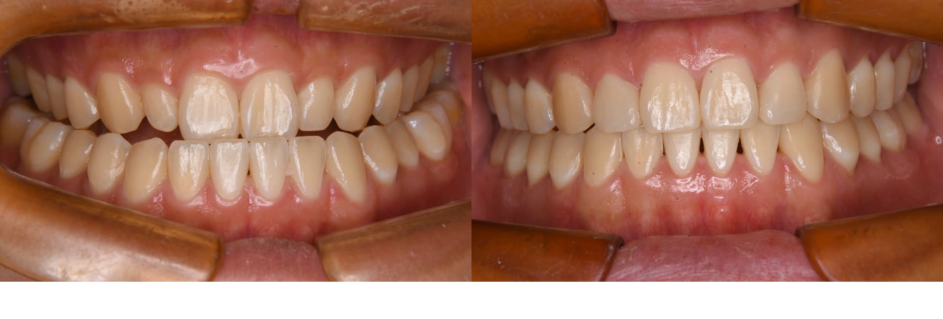 Orthodontic Course Sato Orthodontics IDEA