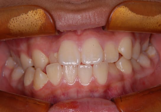orthodontics program education