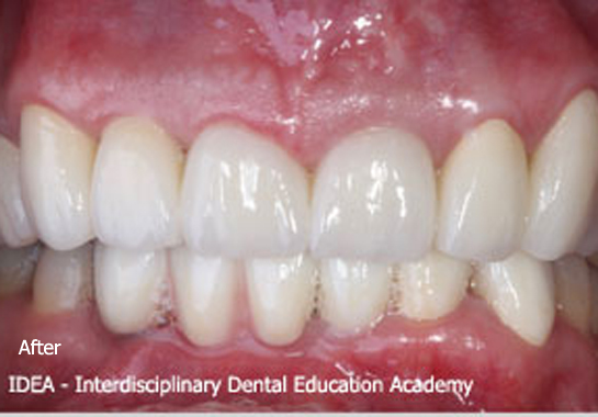 dental-implant-course